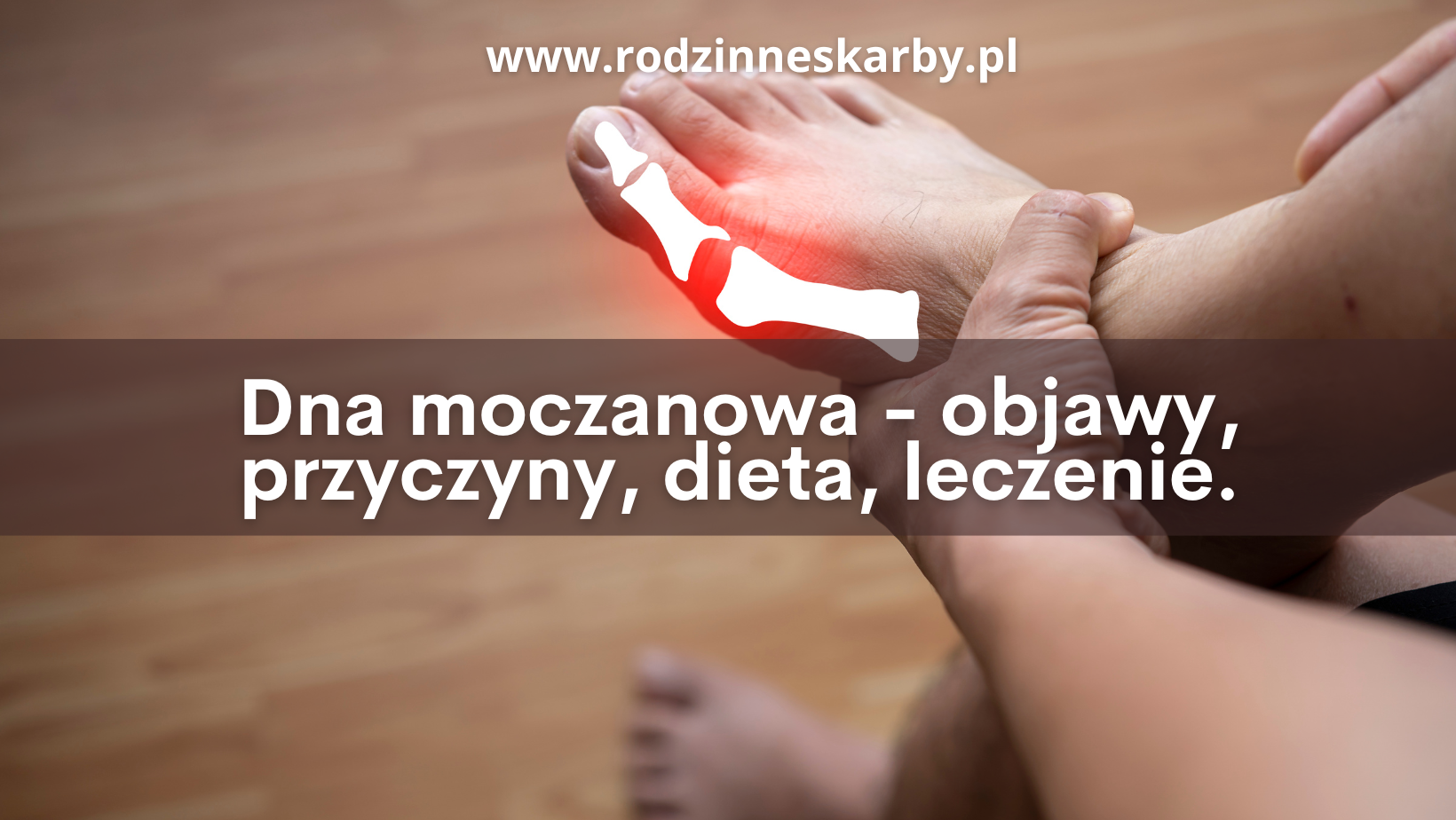 Dna moczanowa – objawy, przyczyny, dieta, leczenie, suplementy.