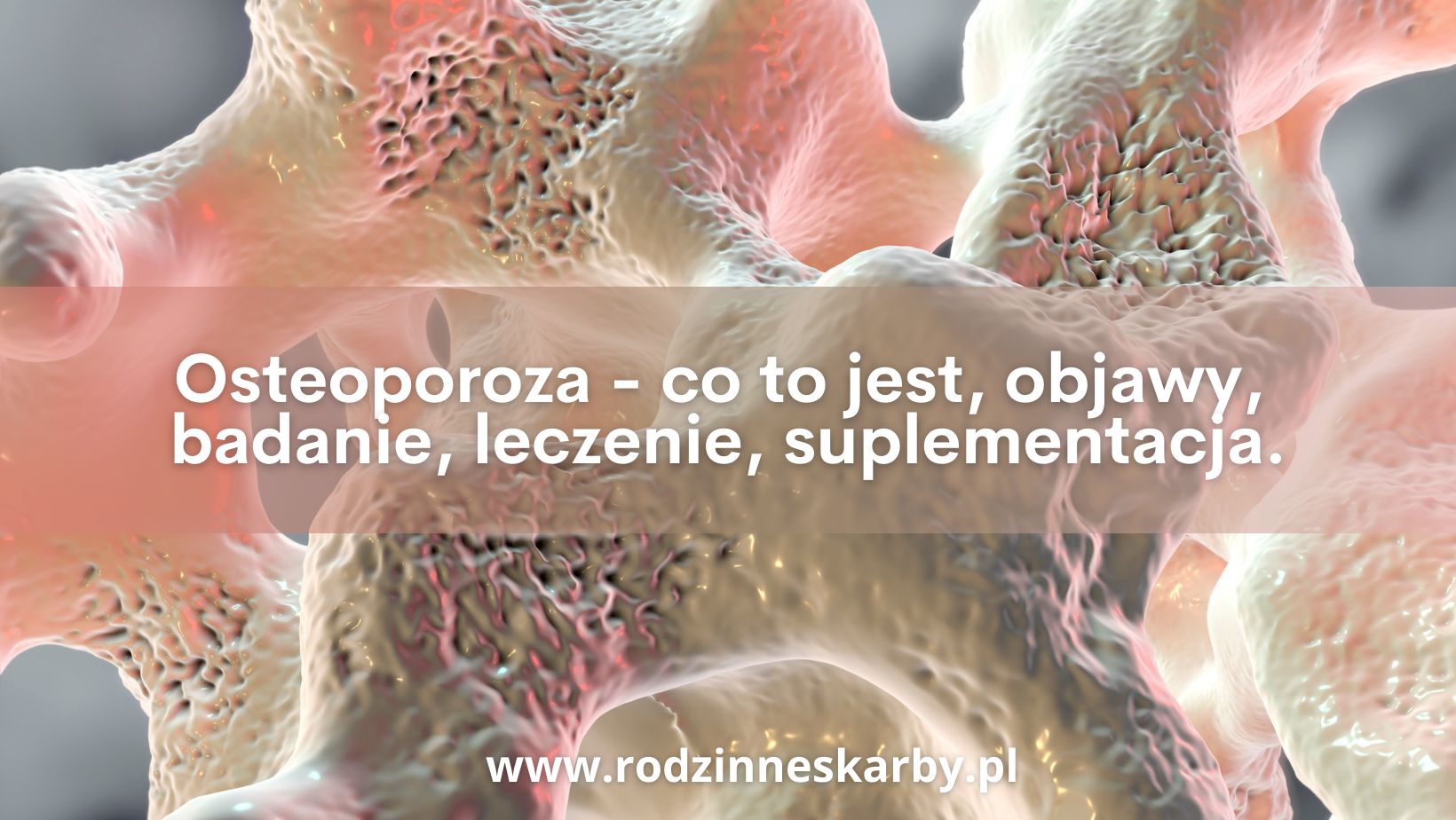 Osteoporoza – co to jest, objawy, badanie, leczenie, suplementacja